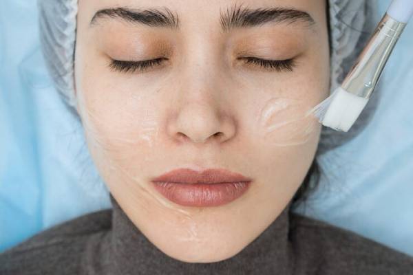 لایه برداری صورت